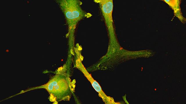 Microscopic view of fluorescently labeled cells showing green cell bodies with blue nuclei connected by thin, bridge-like structures  