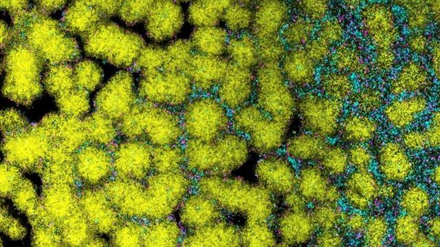 Yellow bacteria clustered closely together on the left side of the image, spreading apart on the right side. 