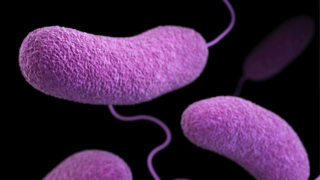 A scanning electron micrograph of vibrio bacteria. 