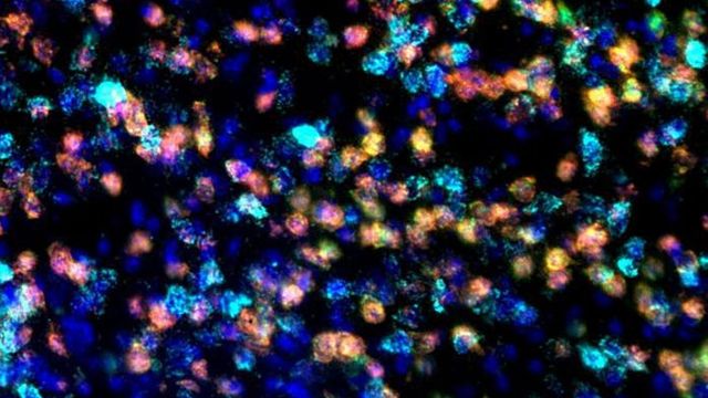 Neurons labelled with green, yellow, light blue and dark blue fluorescent staining. 