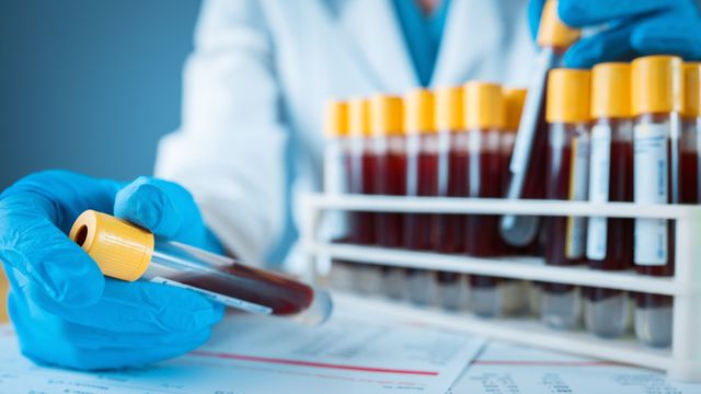 Clinical laboratory worker removing and holding a test tube of blood from a rack containing several samples.  