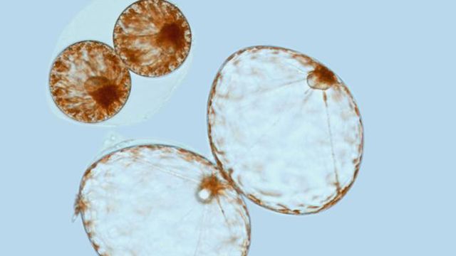 This photograph shows two big and two little Pyrocystis noctiluca. 
