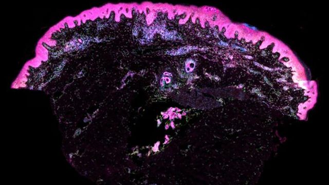 Cell segmentation stain of human skin. 